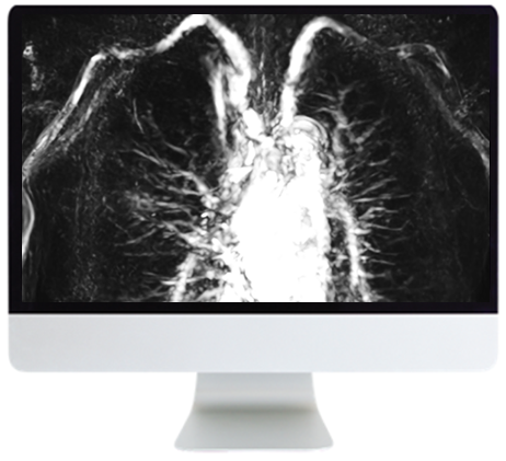 Advanced Chest Imaging