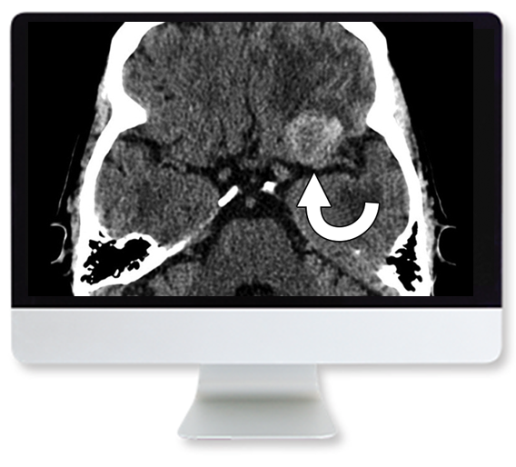 Clinical Case Based Review of Neuroradiology