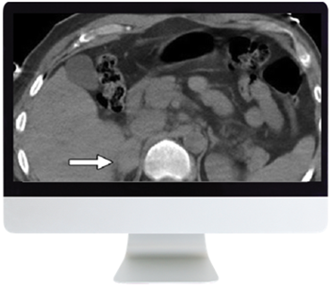 Male Genitourinary Imaging: From Anatomy to Oncology