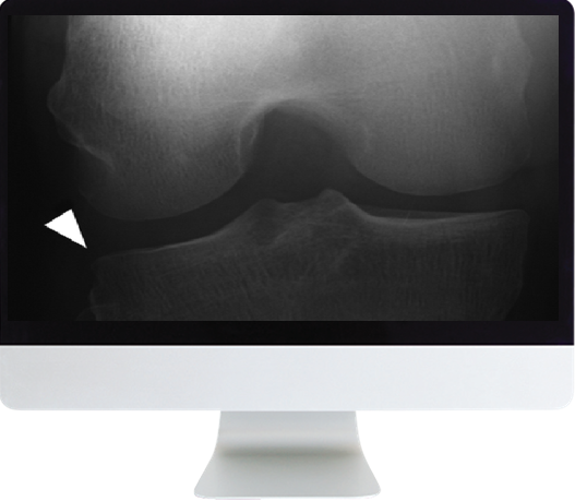 Musculoskeletal Imaging for the Practicing Radiologist Online Course