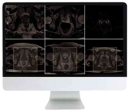 Pearls and Pitfalls in Prostate and Pelvic Imaging Online Course