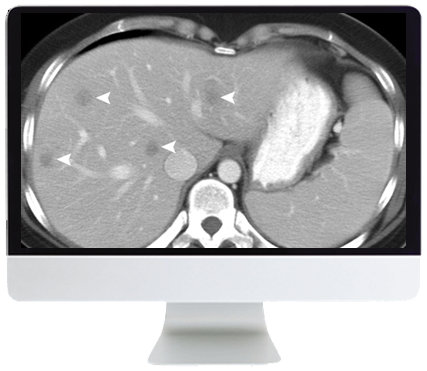 SAR Disease-Focused Panels: Cancer Imaging and Reporting Guidelines Online Course