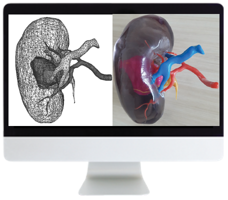 3D Printing of Anatomic Models: Value Added Opportunity for Radiology