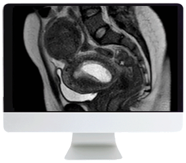 Abdominal MRI: Practical Applications and Advanced Imaging Techniques Online Course