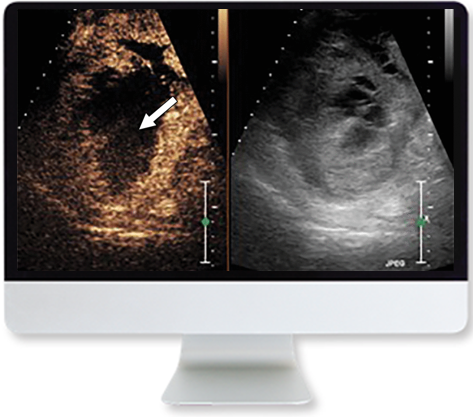 Clinical Case-Based Review of Ultrasound
